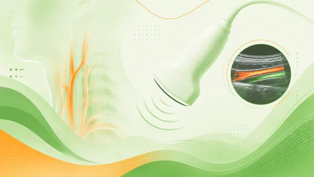 Превью раздела «Carotid arteries»